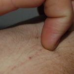 15 korai jele annak, hogy daganatos sejtek lehetnek a szervezetedben! kép