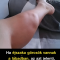 Kik vannak leginkább kitéve az éjszakai izomgörcsök kockázatának?